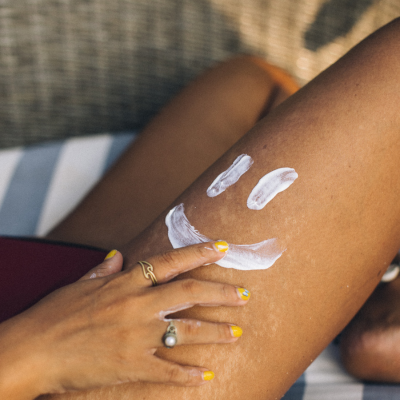 coup de soleil solutions naturelles